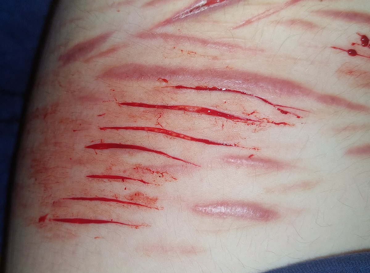 p4ssword101's tweet photo. Relapse https://t.co/6ibONwU3gS