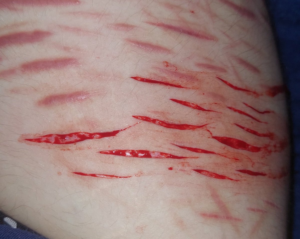 p4ssword101's tweet photo. Relapse https://t.co/6ibONwU3gS