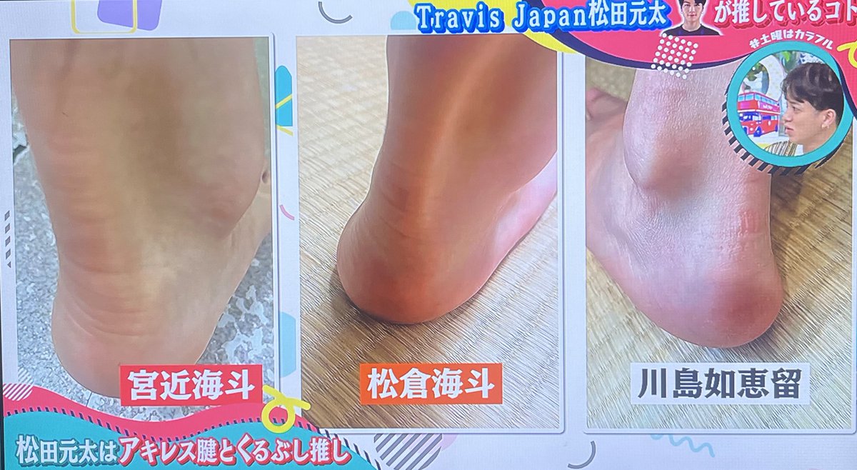 emuuu_074's tweet photo. 元太「宮近は丸みがあって可愛らしい、嫌いになれない。松倉と如恵留はスタイリッシュでエヴァンゲリオンのような綺麗なくるぶし」
#宮近海斗 #松田元太 #土曜はカラフル https://t.co/cfX6feKYRL