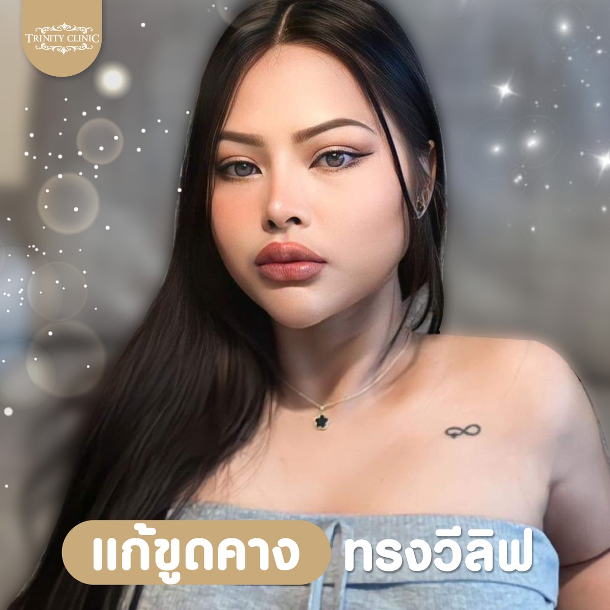 trinityclinic01's tweet photo. ทรง ฝอ ทรงแขกชามีลา สวยแบบเป๊ะแบบแซ่บ #น้องฟ้า
สอบถามเพิ่มเติม 095-5150547
https://t.co/ZOoqKMZwfR
#เสริมจมูก #ศัลยกรรมสวย #NTLT #ทรินิตี้คลินิก #รีวิวบิวตี้ #เน็ตไอดอล #ศัลยกรรม #รีวิวศัลยกรรม #botox #ฟิลเลอร์ #HIFU #หน้าตึง #beauty #TwitterX https://t.co/90999E5ze1