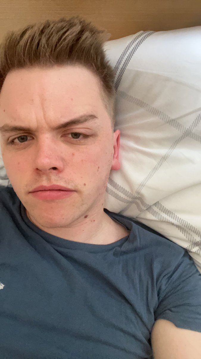 Woke up with a stye ffs