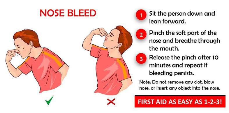 8. Mimisan

PERTOLONGAN PERTAMA MIMISAN harusnya gini:
1. Duduk tegak &amp; condongin tubuh ke depan
2. Tekan cuping hidung selama ±10 menit
3. Kompres dingin pada pangkal hidung
4. Setelah 10 menit, lepas
5. Apakah masih mengalir? Klo iya, ulangi