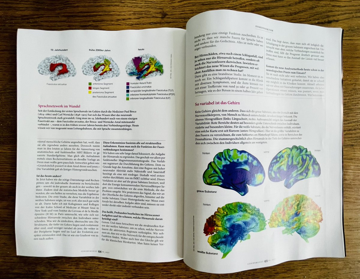 StephForkel's tweet photo. Very proud and honoured that our team’s work is featured in the September edition of Gehirn&Geist. Many thanks to Anna von Hopffgarten for the lovely interview and hard copy.
https://t.co/G1lpsmX6Y4
#neurovariability #disconnectome #whitematter #brain #cognition #language https://t.co/0l3gth37CG