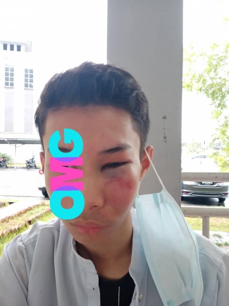 NuzulRazak's tweet photo. Akibat buli, BULI MASIH BERLAKU!

Kali tok di SMK Agama di Kuching, Sarawak. Mun mati anak orang apalah di pikir miak tok. Astaga 😭😭😭 https://t.co/FhD763vjNT