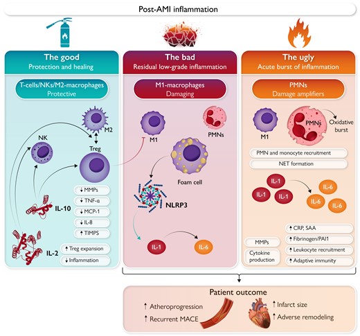 EHJ Editor-in-Chief (@ehj_ed) on Twitter photo Inflammation in acute myocardial infarction: must-read state of the art review summarizes the knowledge in the field
doi.org/10.1093/eurhea…
#inflammation #CAD #MI #cardiotwitter <a href="/ESC_Journals/">European Society of Cardiology Journals</a> <a href="/escardio/">European Society of Cardiology</a> Inflammation in acute myocardial infarction: must-read state of the art review summarizes the knowledge in the field
doi.org/10.1093/eurhea…
#inflammation #CAD #MI #cardiotwitter <a href="/ESC_Journals/">European Society of Cardiology Journals</a> <a href="/escardio/">European Society of Cardiology</a>
