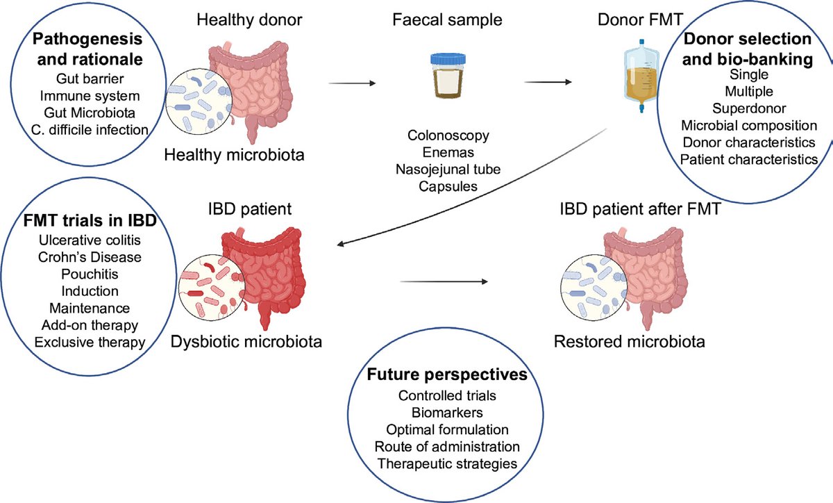 #GUTImage from the #GUTGuideline by @LRLopetuso @DeleuSara et al on 'The first international Rome consensus conference on gut #microbiota and #FMT in #IBD' via gut.bmj.com/content/72/9/1… @LGodny @h_sokol @gianluca1aniro @ibddocmaria @Iris_Dotan @alearmuzzi @GiovanniCammar9