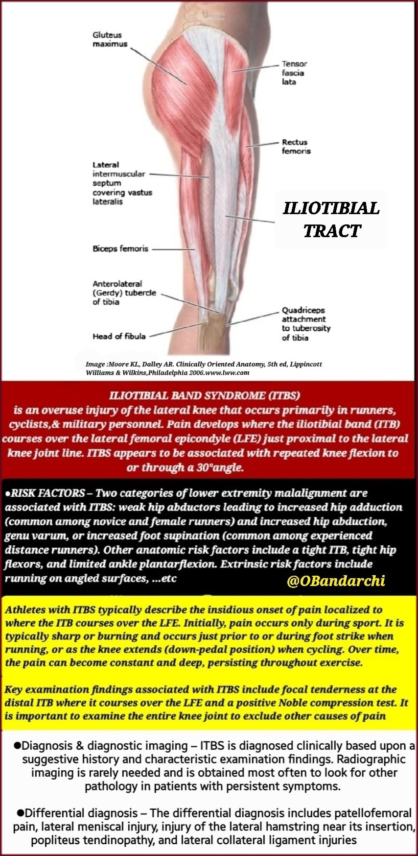 Dr. OMID BANDARCHI on X: Iliotibial band syndrome(ITBS): an overuse injury  causes knee pain or, less often,hip pain. It occurs when the iliotibial band  (IT band) becomes overly tight & irritated. It's
