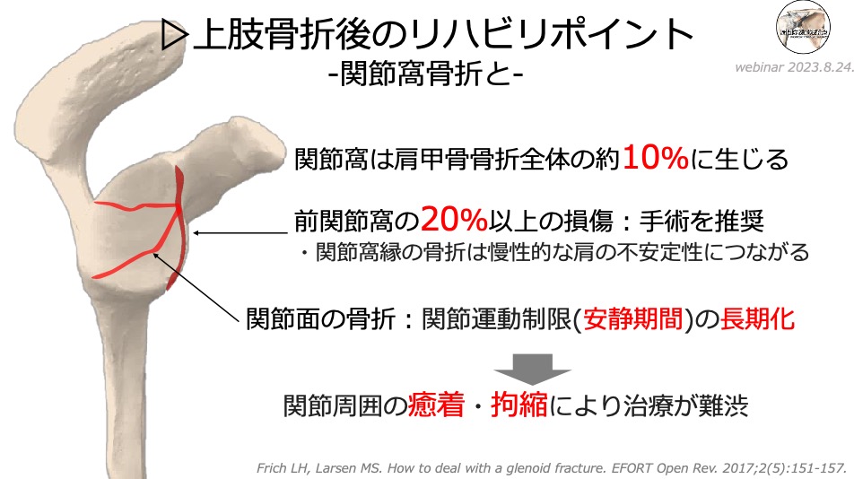 サイズ25~27、左足首骨折、距骨骨折、荷重調整装置付き サイズ25~27、左足首骨折、距骨骨折、荷重調整装置付き