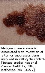 PeterItebimien's tweet photo. @dermatology Melanoma aka malignant melanoma,is a potentially very serious skin cancer in which there is an uncontrolled growth of melanocytes.*In situ,if a tumour is confined to the epidermis
*Invasive,if a tumour has spread into the dermis
*Metastatic,if a tumour has spread to other tissues https://t.co/skJsOPw30W