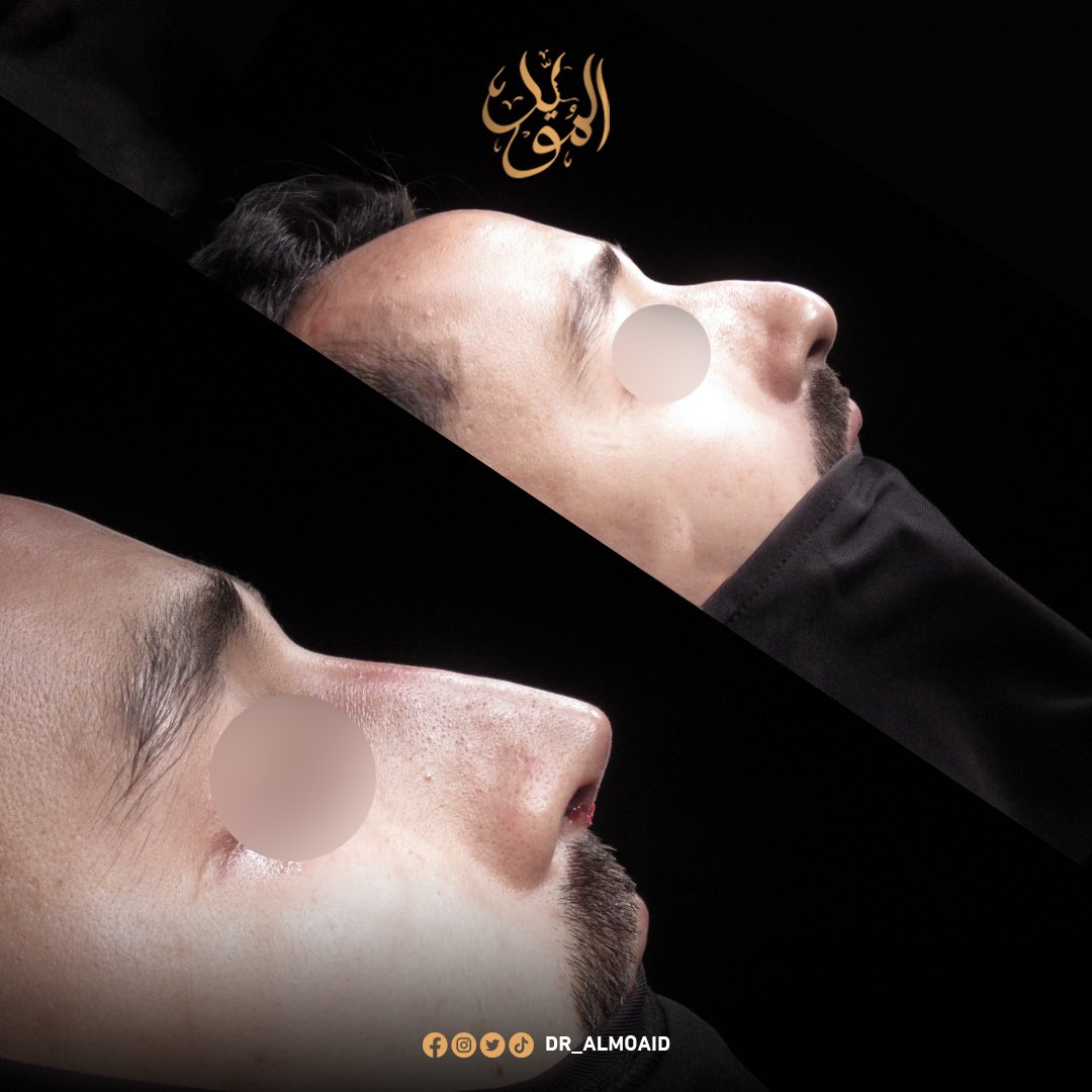 Dr.Almoaidbellah Rammal د.المؤيدبالله رمال tweet media