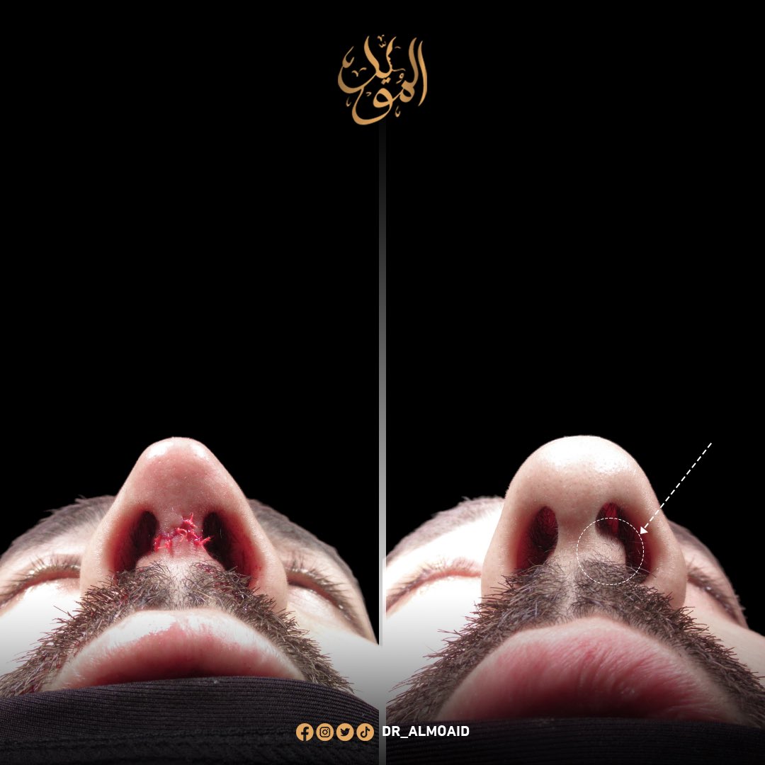 Dr.Almoaidbellah Rammal د.المؤيدبالله رمال tweet media