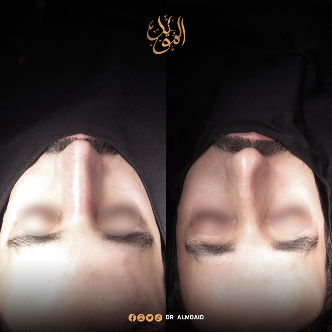 Dr.Almoaidbellah Rammal د.المؤيدبالله رمال tweet media