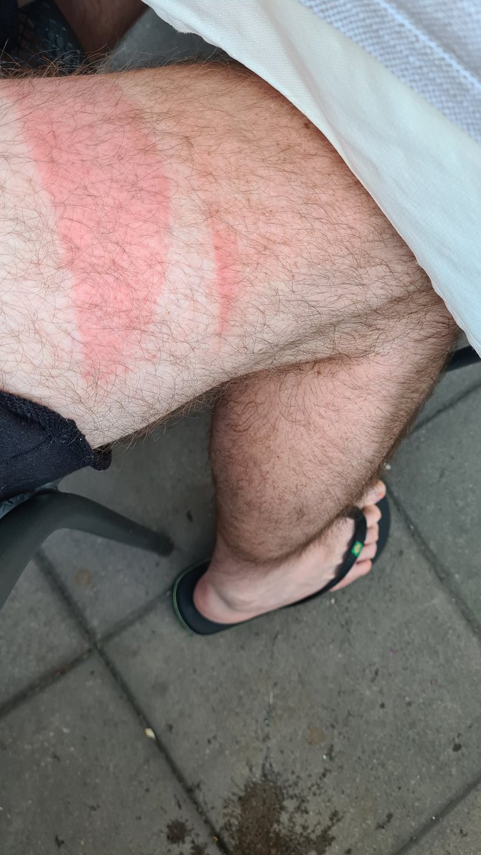 highfielder80's tweet image. I mean, how??? #GingerProblems