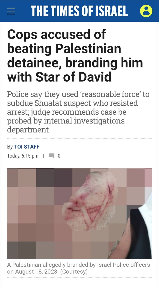 AndyRogers07's tweet image. what would Zionists do if a #Palestinian branded a Zionist-Jew like cattle breeders do to cattle? 👇👇👇
Never heard of some criminal act like this in the history of man.
this shows you when we call these Zionists as savage animals, we are demeaning the animals.