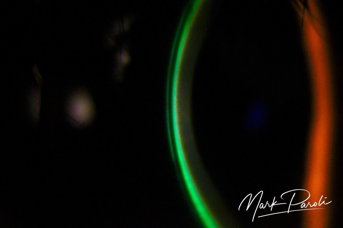 its_MarkParoli's tweet photo. Scleral Lens fitting of a Cornea with Keratoconus s/p Corneal Crosslinking. 200 microns near the apex of the Keratoconus. #scleral #sclerallens #keratoconus #crosslink #optometry #ophthalmology #cornea #contactlens https://t.co/ftZiJpir5D