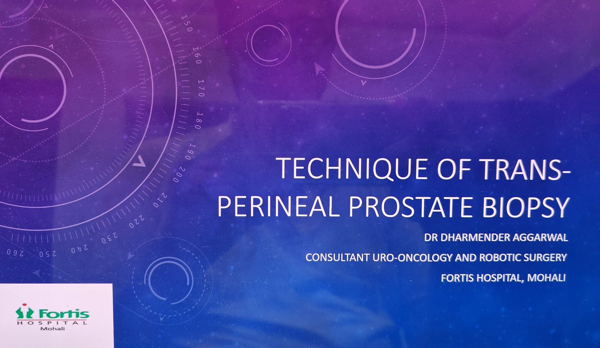 Dharmender Aggarwal (@dharmender8888) on Twitter photo Feeling great to be able to present the technique of Trans-perineal prostate biopsy in the recent mid term CME by NZUSI on Uro-oncology. Trans perineal biopsy has great advantage in avoiding infection and sepsis. Thanks to my mentors <a href="/HARQazi/">Hasan Qazi</a> <a href="/GeorgesUrology/">St George's Urology</a> <a href="/FortisMohali/">Fortis Mohali</a> Feeling great to be able to present the technique of Trans-perineal prostate biopsy in the recent mid term CME by NZUSI on Uro-oncology. Trans perineal biopsy has great advantage in avoiding infection and sepsis. Thanks to my mentors <a href="/HARQazi/">Hasan Qazi</a> <a href="/GeorgesUrology/">St George's Urology</a> <a href="/FortisMohali/">Fortis Mohali</a>