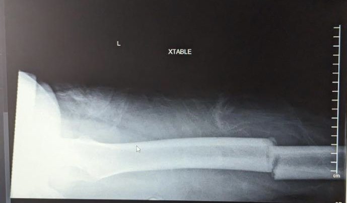 Nick Dewhirst tweet media