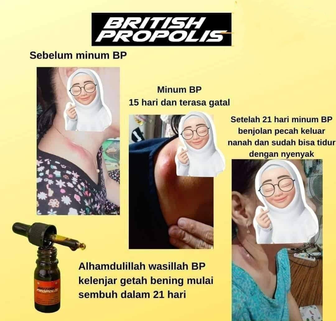 M1Roni's tweet photo. British Propolis bantu atasi penyakit kelenjar getah bening. Alhamdulillah..

https://t.co/Dx6nJVyDbG https://t.co/HPIzgoN6mE