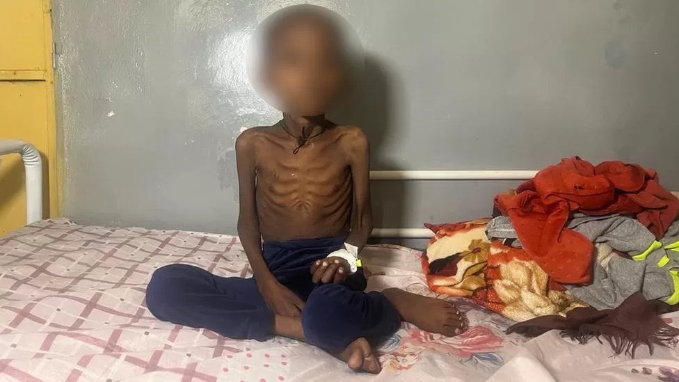 EdenBFKN's tweet photo. @FMoHealth So are you sending RUSF &amp; RUTF, nutrition supplements for children and pregnant mothers to #Tigray? How many more children must die under your watch @lia_tadesse, just have a heart and do what’s expected of you. #ResumeAid4Tigray today. https://t.co/IUrwUSIxR5