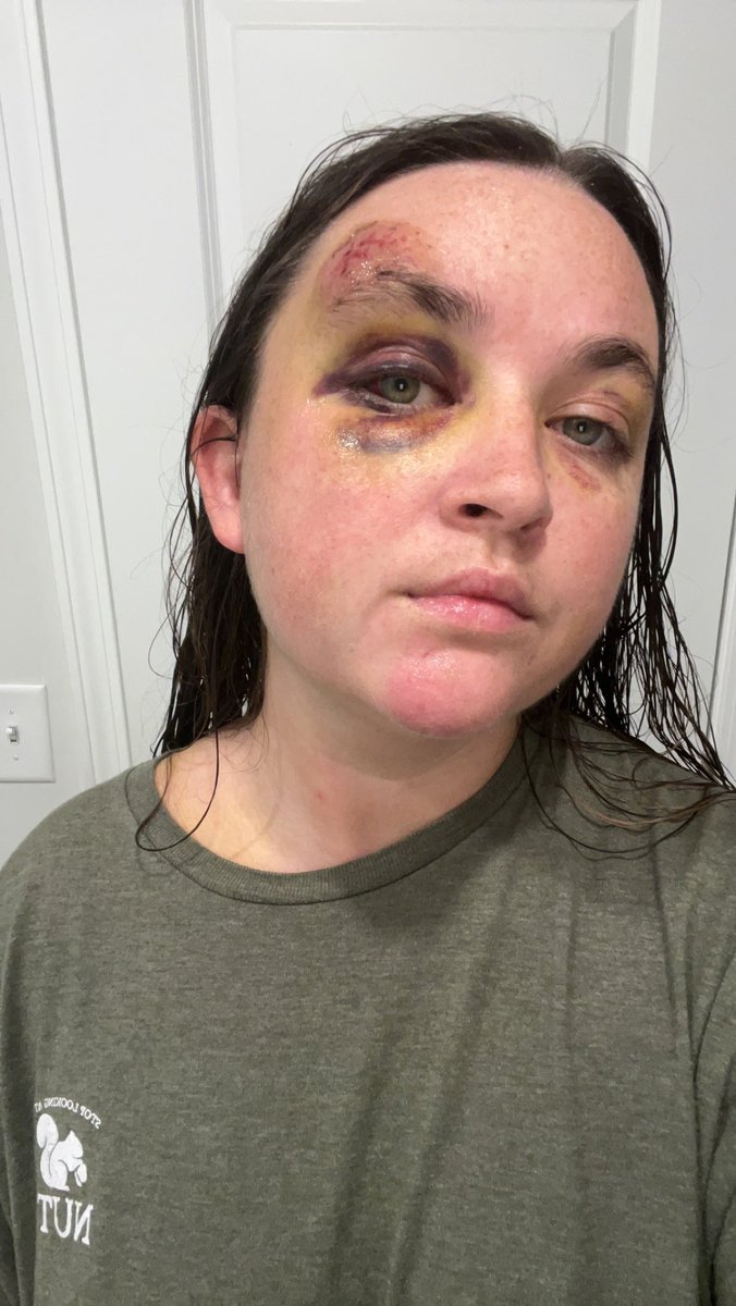 CourtneyLaun's tweet photo. Taking it day by day https://t.co/nBrcjeHTfE