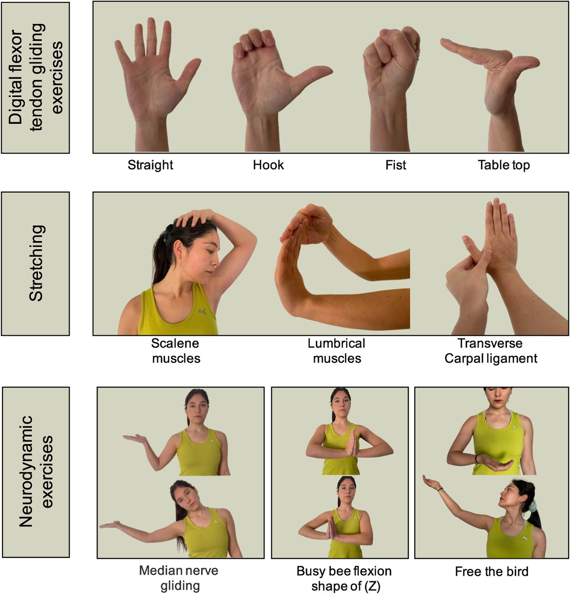 Effectiveness of adding pain neuroscience education (PNE) to telerehabilitation in patients with carpal tunnel syndrome 🤚 (CTS): A randomized controlled trial

👇👇👇

pubmed.ncbi.nlm.nih.gov/37572618/