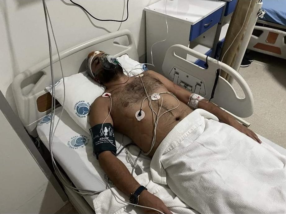 Gaziantep'te bir hastanede çocuk hastaya müdahale edilirken hekim arkadaşımız hasta yakınları tarafından vahşice darp edilmiştir. Hekim kafa travması nedeniyle yoğun bakımda tedavi görüyor.Hastane müdürü ve güvenlik görevlisi de vandalların saldırısı sonucu yaralı ve tedavi