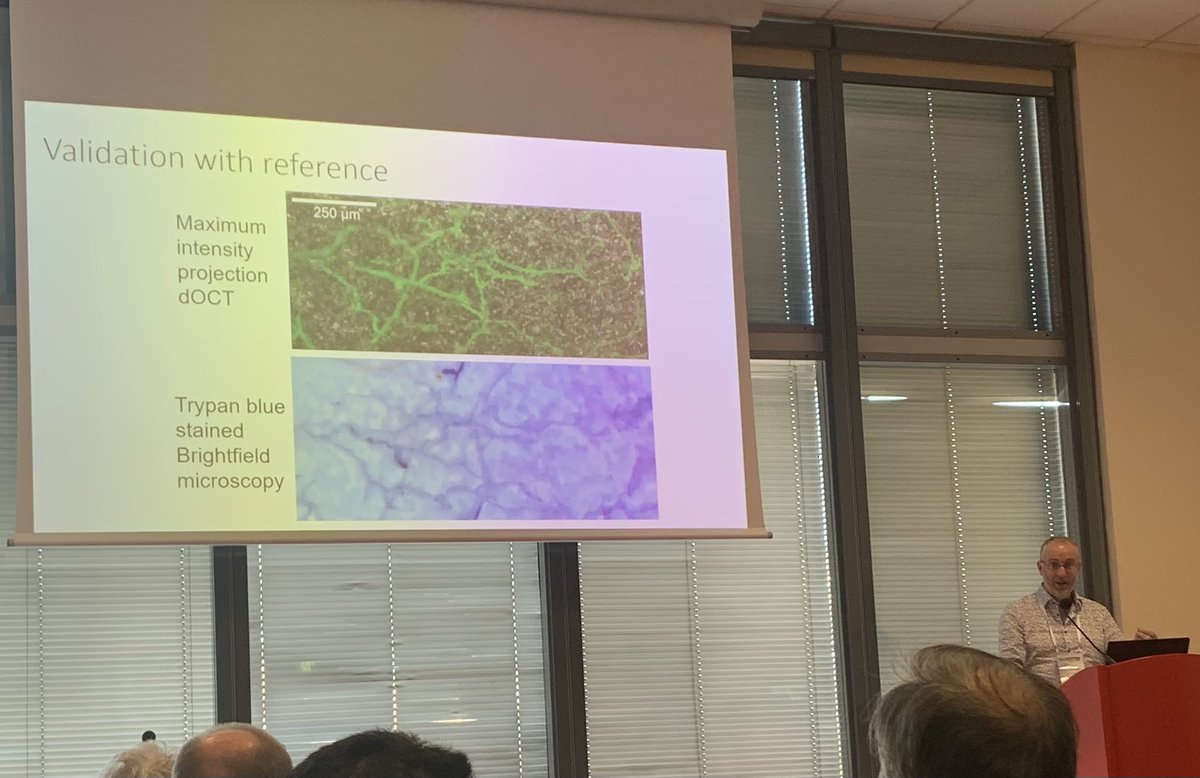 laplap10's tweet photo. @guidopmi on the development of technologies for visualizing downy mildew infection in lettuce without staining before visual symptoms appear @icpp2023 #OMGN @sebtonn https://t.co/kDCUt4SlyV