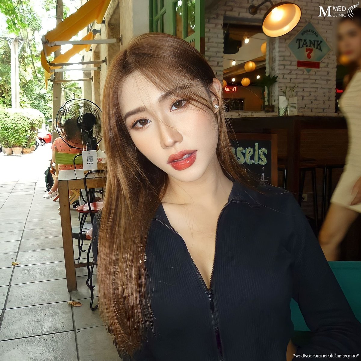 ClinicMmed's tweet photo. บอกลาหนวดแมว   ยิ้มสวยมั่นใจ จนใครๆก็ชม
🎉 L!ne : @mmedclinic ( มี@ข้างหน้าด้วยนะคะ) หรือคลิก https://t.co/7JqdBMkcqA 📷จองคิวปรึกษาฟรี  #mmedclinic #เอ็มเมดคลินิค #รีวิวเอ็มเมด #ฉีดผิว #โปรดีบอกต่อ #Botox #filler #ฟิลเลอร์ #สิว #ฟิลเลอร์ปาก https://t.co/hSZLi6uG34