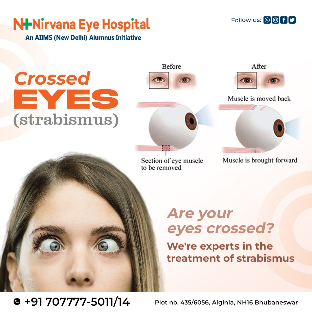 HospitalNirvana's tweet photo. 👁️Strabismus can be a challenging condition, but it doesn't have to control your life. 📞Contact Nirvana Eye Hospital today to learn more.
#EyeHealth #OpticalCare #EyeClinic #VisionWellness #EyesightMatters #OptometryExpertise https://t.co/qhqZuQMSfl