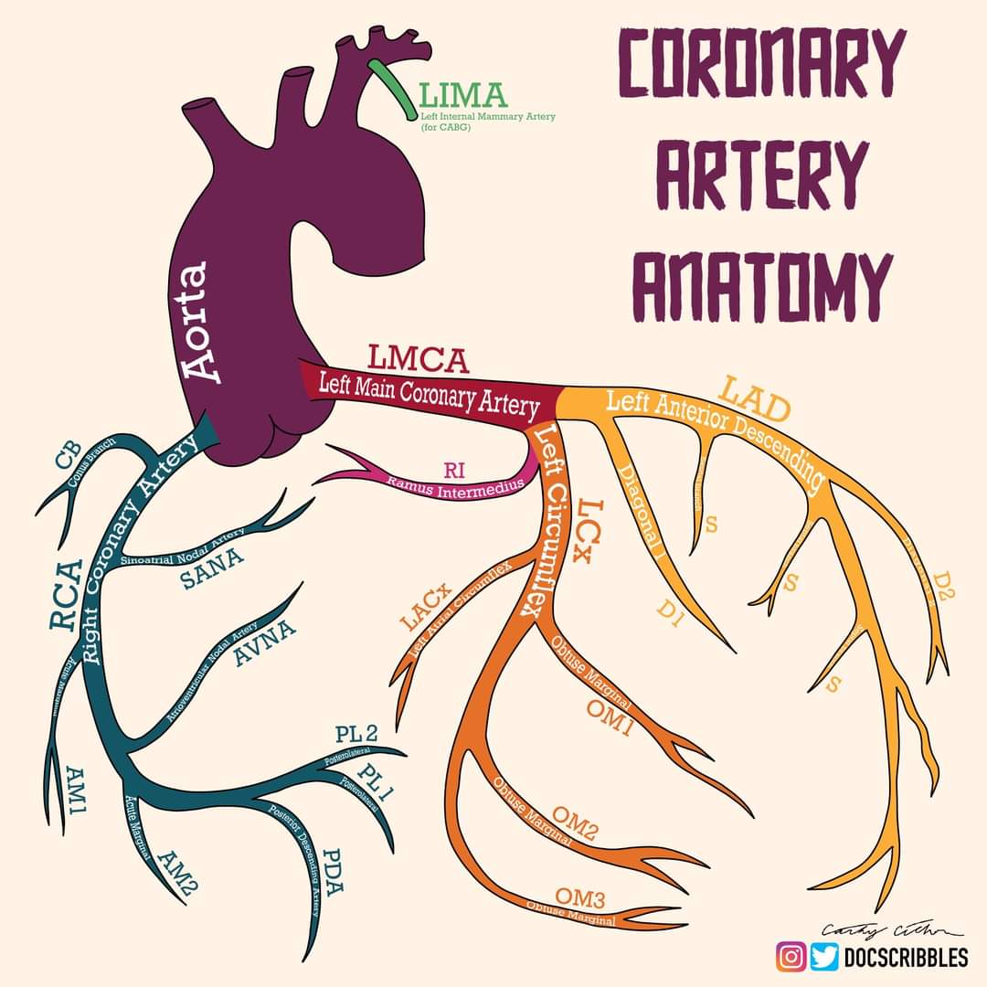 walinjom's tweet photo. Coronary artery anatomy; https://t.co/EkIXhIlb2b