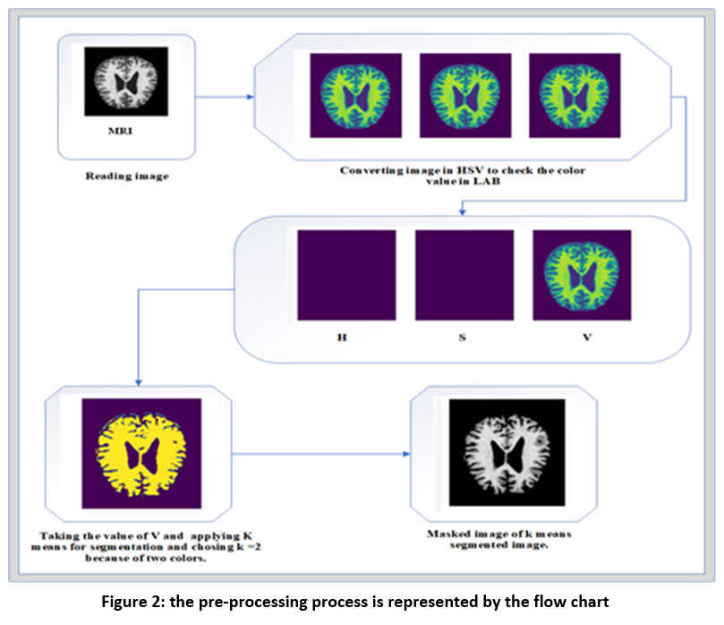 biomed_pharma's tweet image. Hybrid Model: Deep Learning Method for Early Detection of Alzheimer’s Disease from MRI Images
bit.ly/44EErtZ
#Alzheimerdisease #Convolutionneuralnetwork #InceptionV2 #ResNet50 #Magneticresonanceimaging #biomedical #pharmacology #medicines #pharmaceuticals