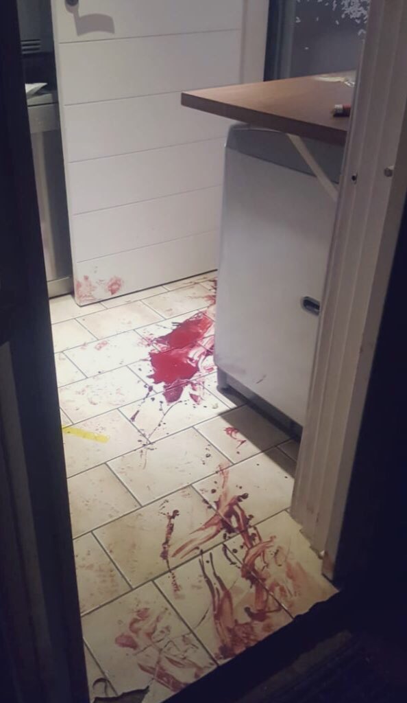 IanCameron23's tweet photo. 1/13🩸WARNING GRAPHIC🩸
This is a thread of a few photos myself or colleagues of mine took over the years at farm attack scenes, some from newspapers &amp; others reports or victims after the attack they survived. The aim is not to desensitise but rather to show the crisis is real. https://t.co/3P4s3Ad3m3