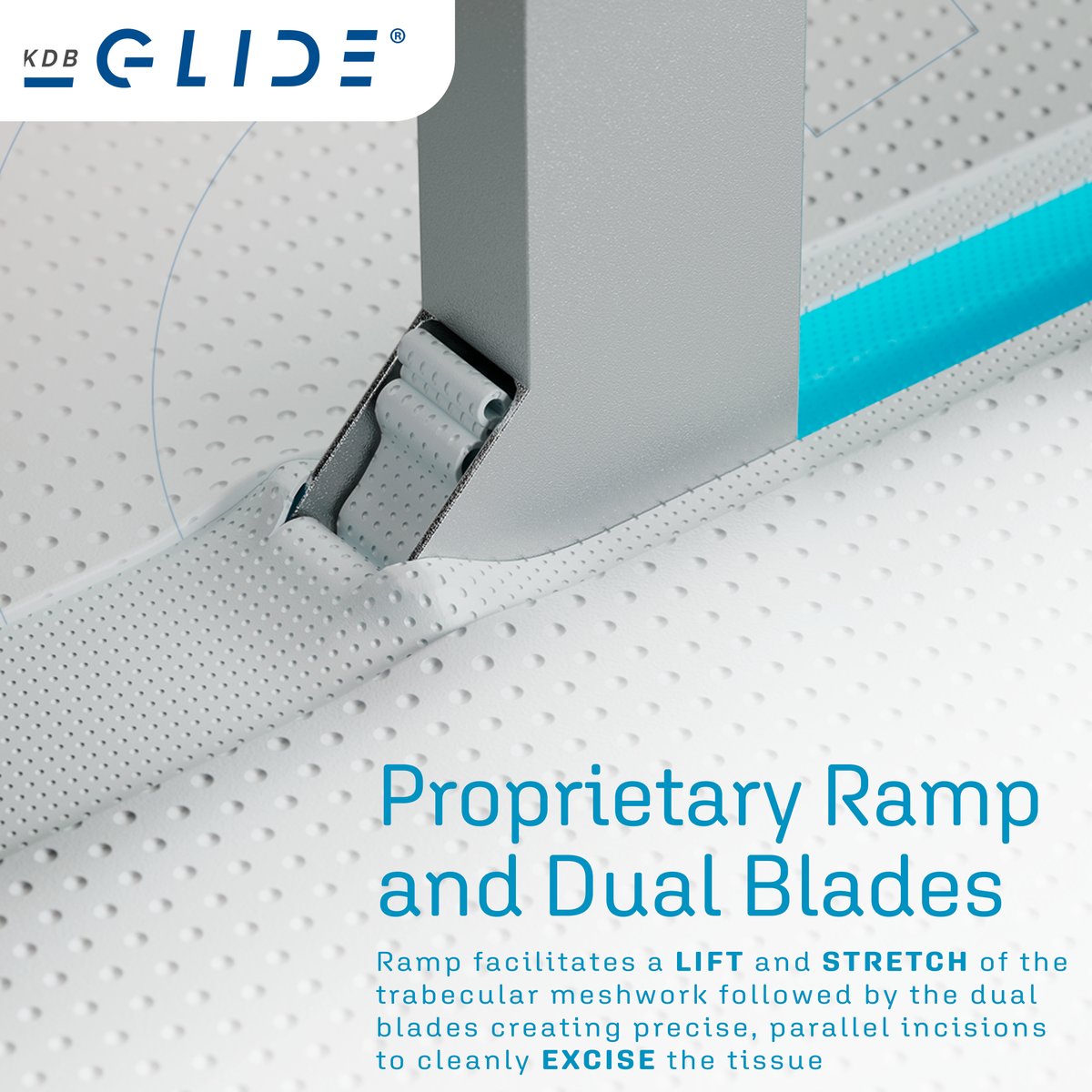 NWM_Inc's tweet photo. #KDBGLIDE is the only #goniotomy device that features a PROPRIETARY RAMP that facilitates a LIFT and STRETCH of the trabecular meshwork & DUAL BLADES that enable precise, parallel incisions to cleanly excise a wide strip of tissue.
Contact Us: https://t.co/Fp3nr4KjPA https://t.co/qljG44Vt5D
