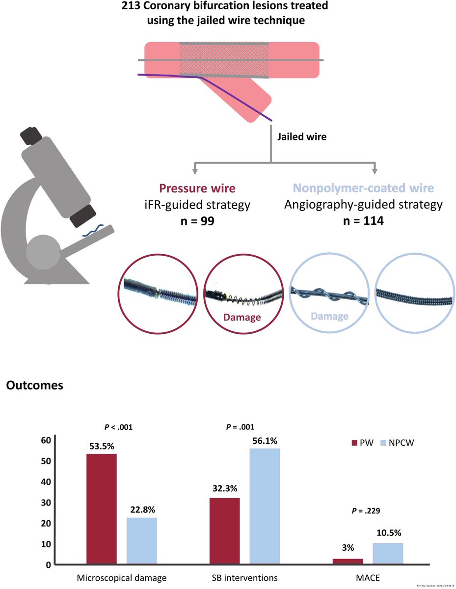REC Publications (@revespcardiol) on Twitter photo Jailed pressure wire technique for coronary bifurcation lesions: structural damage and clinical outcomes #REC #Cardiotwitter <a href="/FranJHidalgo/">Francisco Hidalgo</a> <a href="/rafaelglezm/">Rafael Gonzalez-Manzanares</a> <a href="/OjedaOjeda18/">Soledad Ojeda</a> <a href="/danielpwulf/">Daniel Pastor Wulf</a> <a href="/guiselaflores/">Guisela Flores Vergara</a> <a href="/NachoGalloFer/">Ignacio Gallo</a> <a href="/JosueBaizan/">Josué López Baizán</a> <a href="/cardiojsl/">Javier Suarez d Lezo</a> <a href="/MPAOSS/">Manuel Pan</a> <a href="/Cardio_HURS/">CardioHURS</a> revespcardiol.org//en-jailed-pre… Jailed pressure wire technique for coronary bifurcation lesions: structural damage and clinical outcomes #REC #Cardiotwitter <a href="/FranJHidalgo/">Francisco Hidalgo</a> <a href="/rafaelglezm/">Rafael Gonzalez-Manzanares</a> <a href="/OjedaOjeda18/">Soledad Ojeda</a> <a href="/danielpwulf/">Daniel Pastor Wulf</a> <a href="/guiselaflores/">Guisela Flores Vergara</a> <a href="/NachoGalloFer/">Ignacio Gallo</a> <a href="/JosueBaizan/">Josué López Baizán</a> <a href="/cardiojsl/">Javier Suarez d Lezo</a> <a href="/MPAOSS/">Manuel Pan</a> <a href="/Cardio_HURS/">CardioHURS</a> revespcardiol.org//en-jailed-pre…