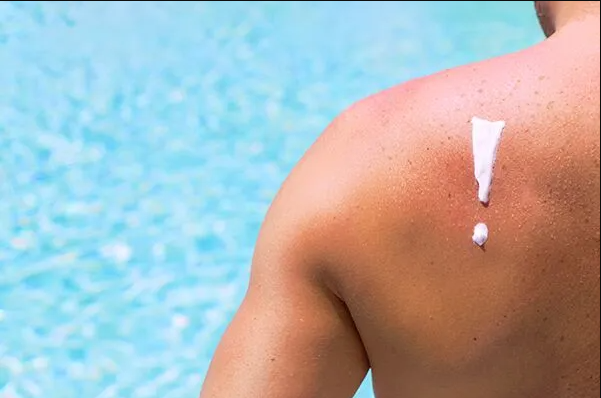 Heat rash is a common summer problem. Read our latest blog about it.
.
#Blog #HeatRash #HeatIllness #Health #Summer
.
afcurgentcare.com/blog/heat-rash…