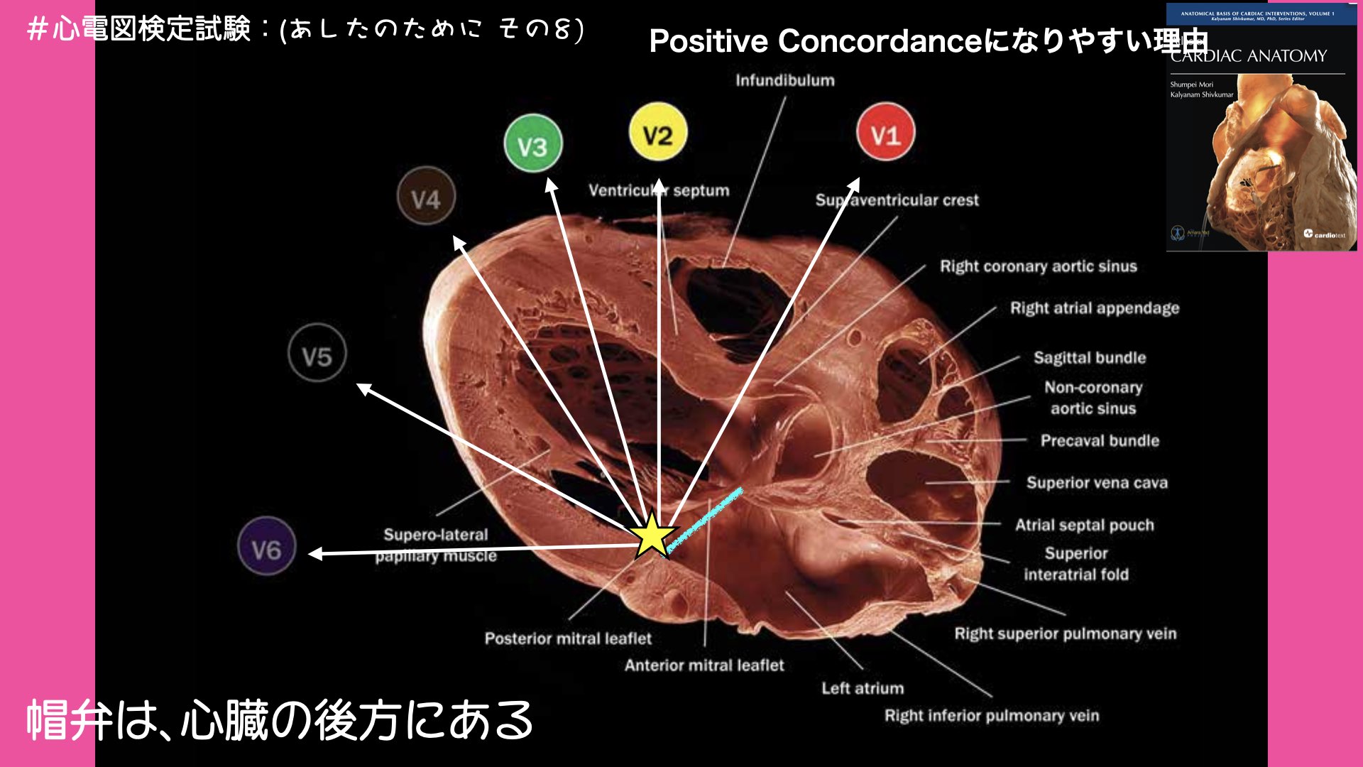 N. Tsukishima EP大学心電図検定学部試験対策科担任 on X