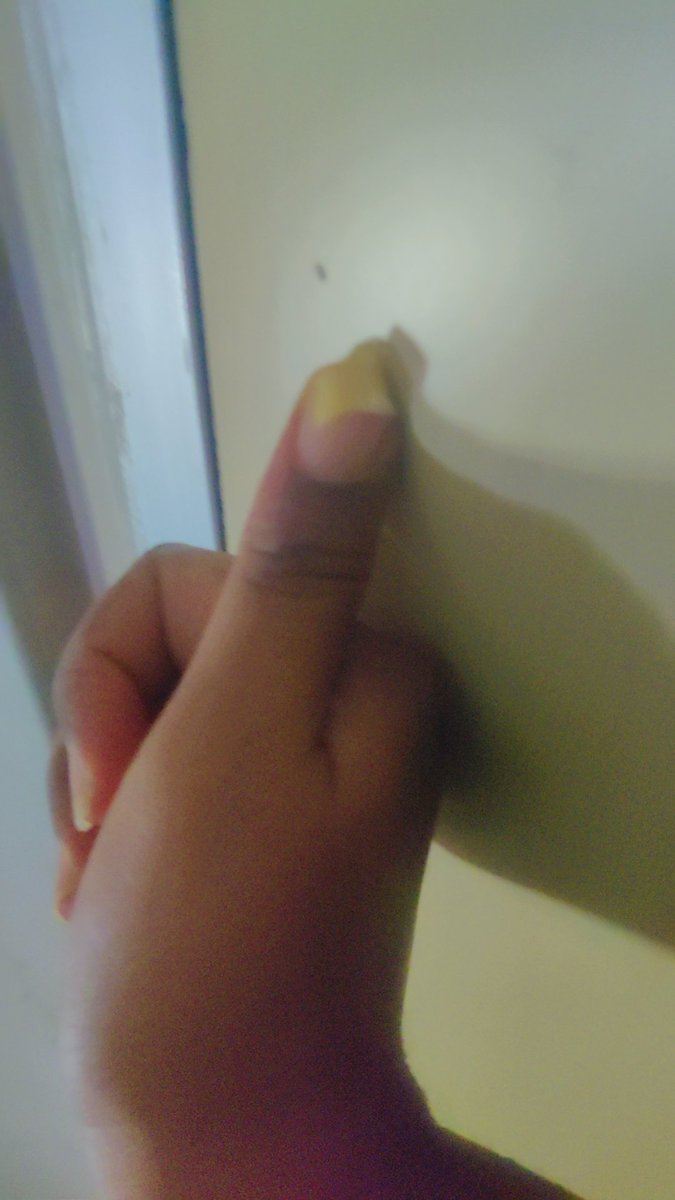 Swathi21603639's tweet photo. Why ?why? Why? Always me๐๐๐๐
#nails #cuts #longnails #thatpain https://t.co/FYvPoXF0Jv