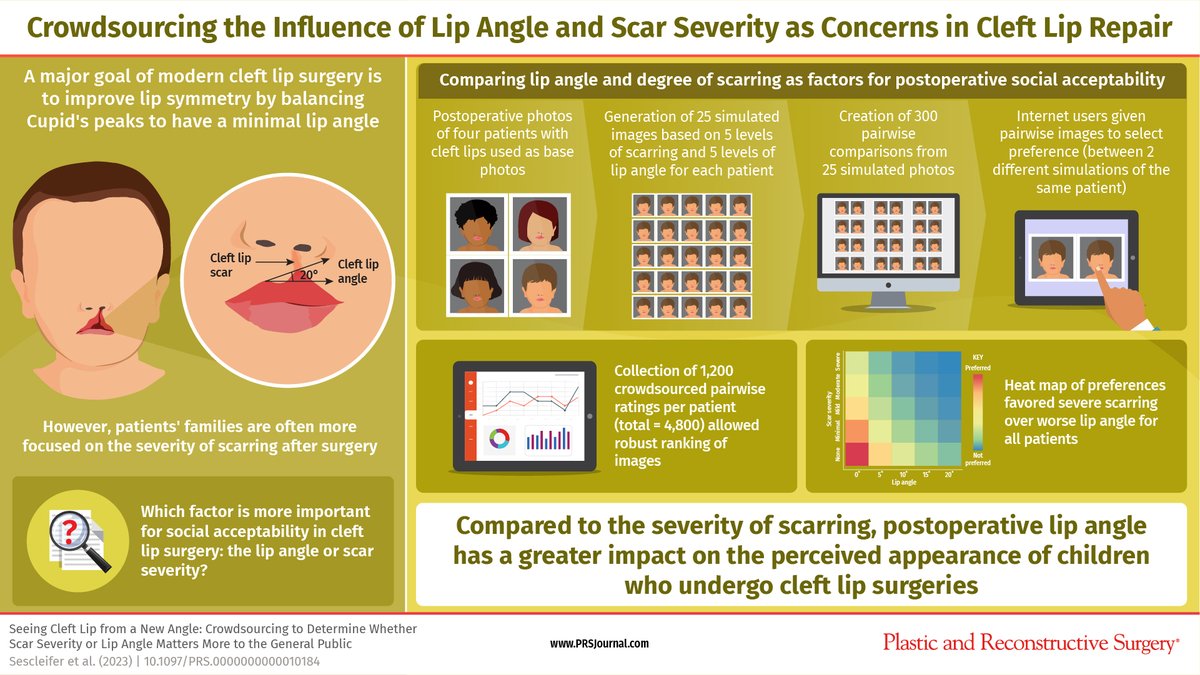 This @PRSJournal study reveals that #uneven #LipAngle has a greater negative effect on perceived appearance of #CleftLips in children than the #severity of #scarring. Find out more here: bit.ly/SeeingCleftLip @AlexLinPlastic