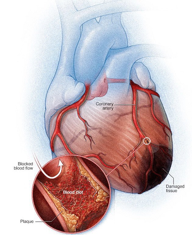 zaidkdahhaj's tweet image. Terrified to die of a heart attack?

Gentlemen, here’s everything you need to know about your standard lipid panel

(This will save you a lot of heartache) 

THE CARDIOVASCULAR BLOODWORK BIBLE THREAD
