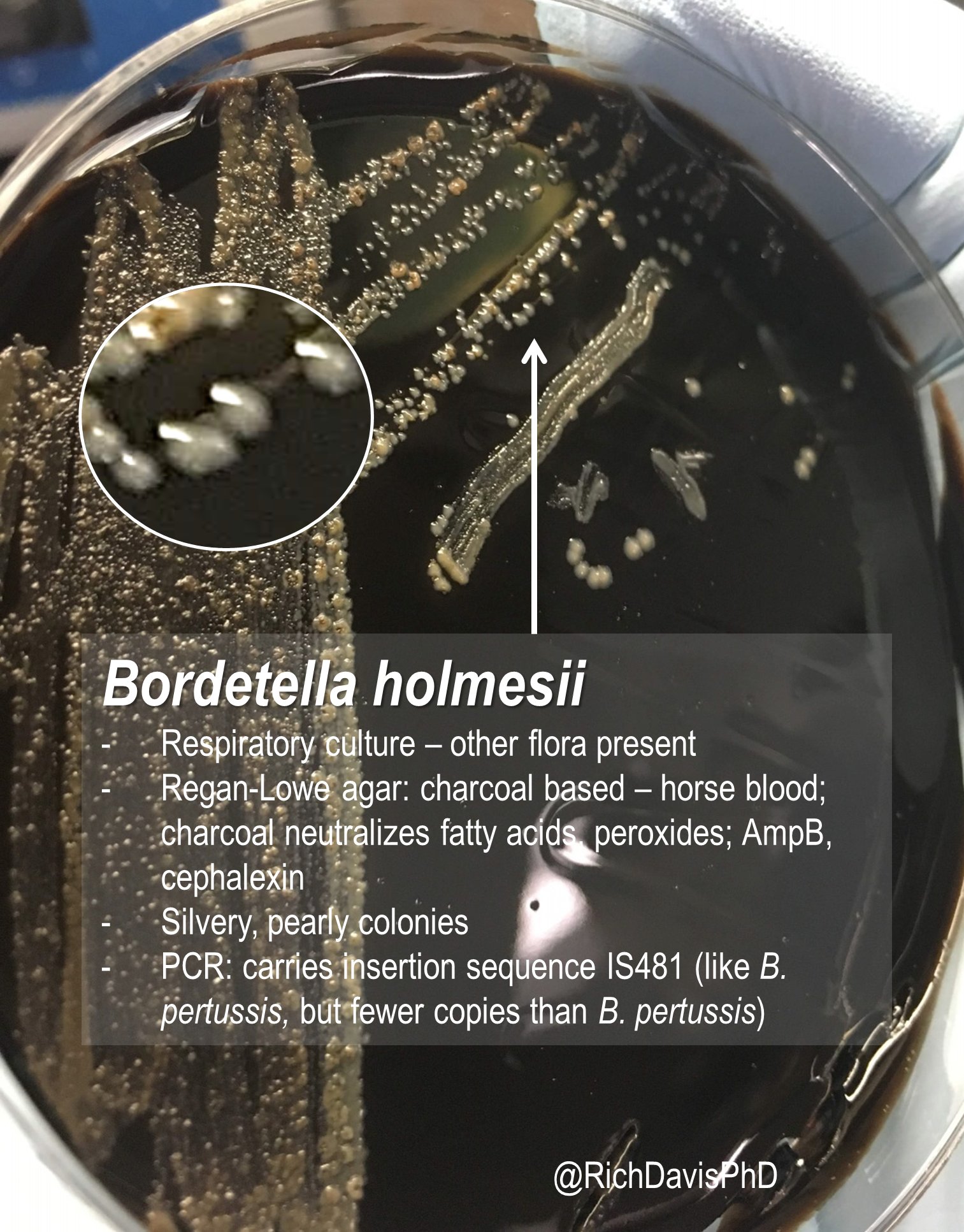 Bordetella Pertussis Culture