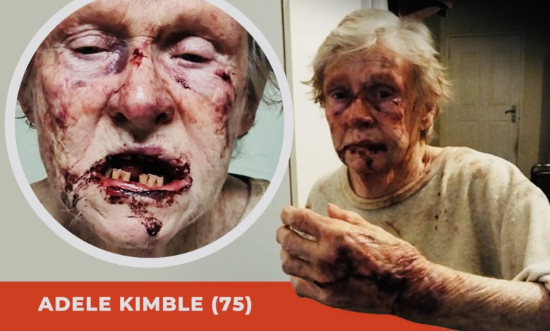 A 75-year-old woman, Adele Kimble, was last night attacked and robbed by two men at her home in Mbombela, South Africa. It is believed that cellphones are the only items stolen during the violent house burglary. Attacks on white farmers are rising in the wake of Julius…