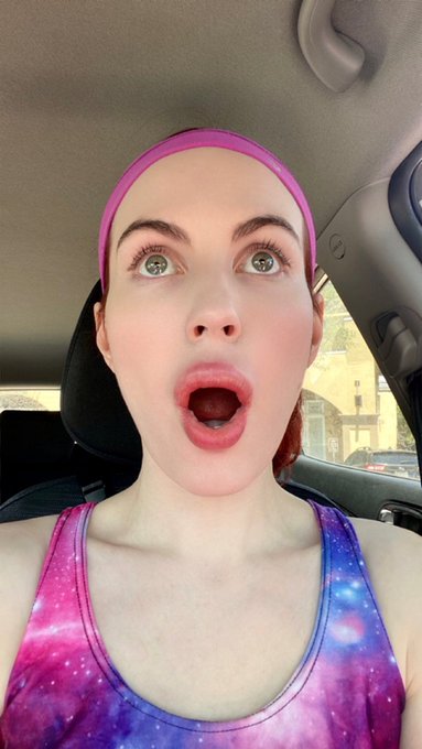 Another day, another allergic reaction. A&ccedil;a&iacute; berries got me lookin&rsquo; like a blowup doll 😂 https://t.c<a href="/tag/piday"class="tags"><span>#piday</span></a><a href="/tag/snowwhitecosplay"class="tags"><span>#snowwhitecosplay</span></a><a href="/tag/piday2024"class="tags"><span>#piday2024</span></a>