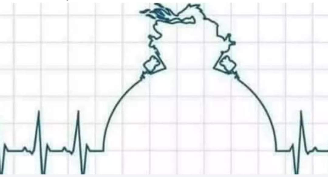 Hoje o coração volta a bater.