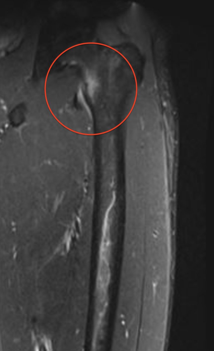 Matt Grimm tweet media