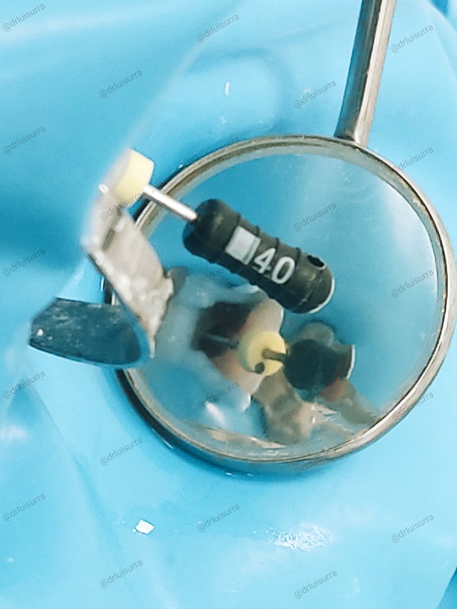 drluisurra's tweet photo. Recuerden, tratamiento de conductos sin aislar, no es tratamiento de conductos 🧑‍⚕️
.
.
 #dentista #odontologia #dientesblancos #dentistry #stunningsmile #cadcam #Irapuato #guanajuato #dentist #endodoncia #rootcanal #protesisdental #bichectomia #esteticadental #endodoncia https://t.co/EGHFv0KqDi