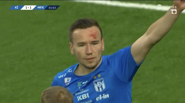 lukasernryd's tweet photo. Blir sport vackrare? Klaksvik vände 0-1 till 2-1 mot Molde och dundrar vidare i jakten mot Champions leauge. Allt tack vare Fredriksberg. En Molde-spelare tacklade honom blodig och en minut senare uppfann han en yta från ingenstans och gjorde mål. Sen gjorde ha ett till. https://t.co/BC2AOwycTU