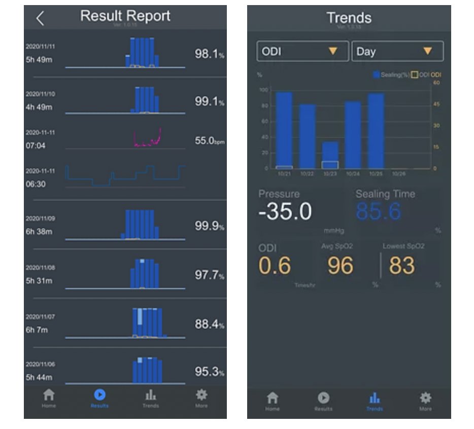 iNAPsleep's tweet photo. Reflect on the progress you've made in understanding and managing sleep apnea. Take charge of your sleep treatment journey with the iNAP Lab+ app! 📱🌙Get personalized insights for better sleep. #iNAPLabPlus https://t.co/JQSr2P2yoM #SleepTreatment #SleepProgress https://t.co/Etbw53k8h2