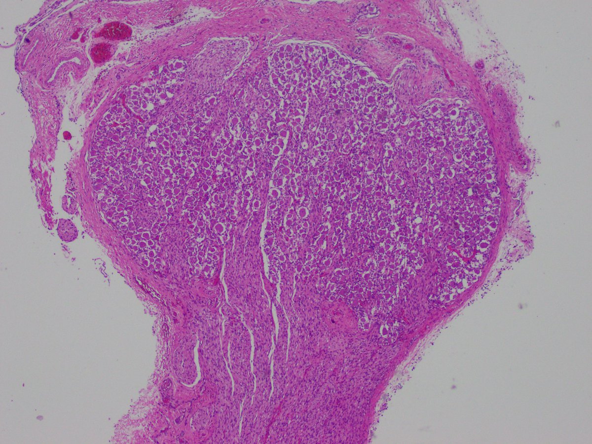 YMirzabeigi's tweet photo. Hey #PathTwitter! Let’s enjoy some #NormalHistology. What is this cute structure? @UMiamiPathology https://t.co/k4JjhGnNIF