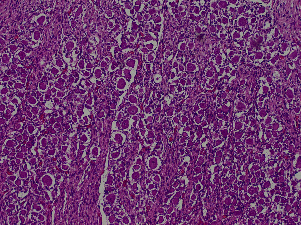 YMirzabeigi's tweet photo. Hey #PathTwitter! Let’s enjoy some #NormalHistology. What is this cute structure? @UMiamiPathology https://t.co/k4JjhGnNIF