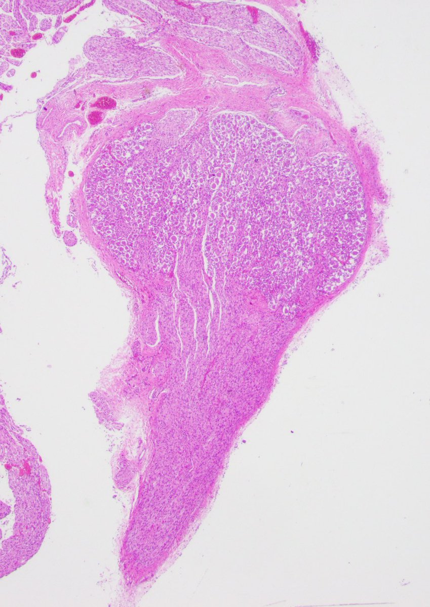 YMirzabeigi's tweet photo. Hey #PathTwitter! Let’s enjoy some #NormalHistology. What is this cute structure? @UMiamiPathology https://t.co/k4JjhGnNIF